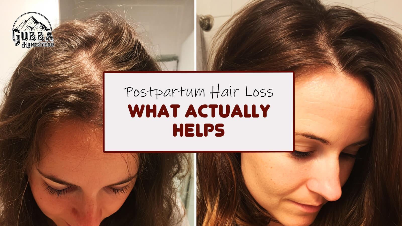 Postpartum Hair Loss: What’s Normal, What’s Not, and What Actually ...